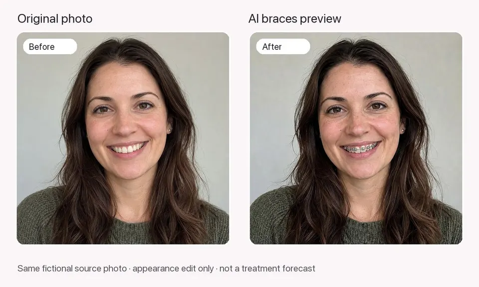 5. Compare — APOB AI